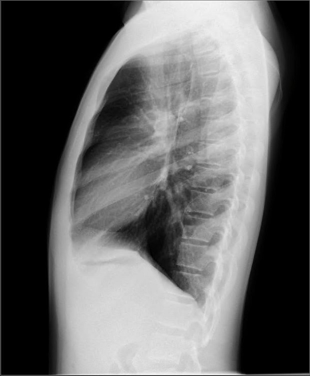 Continuum: Contusiones pulmonares y otras lesiones asociadas al ...